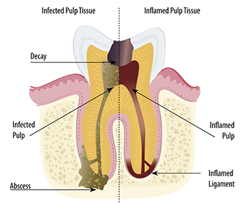tooth anatomy diagram