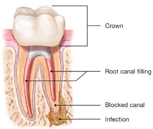 tooth anatomy diagram