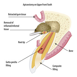 tooth anatomy diagram